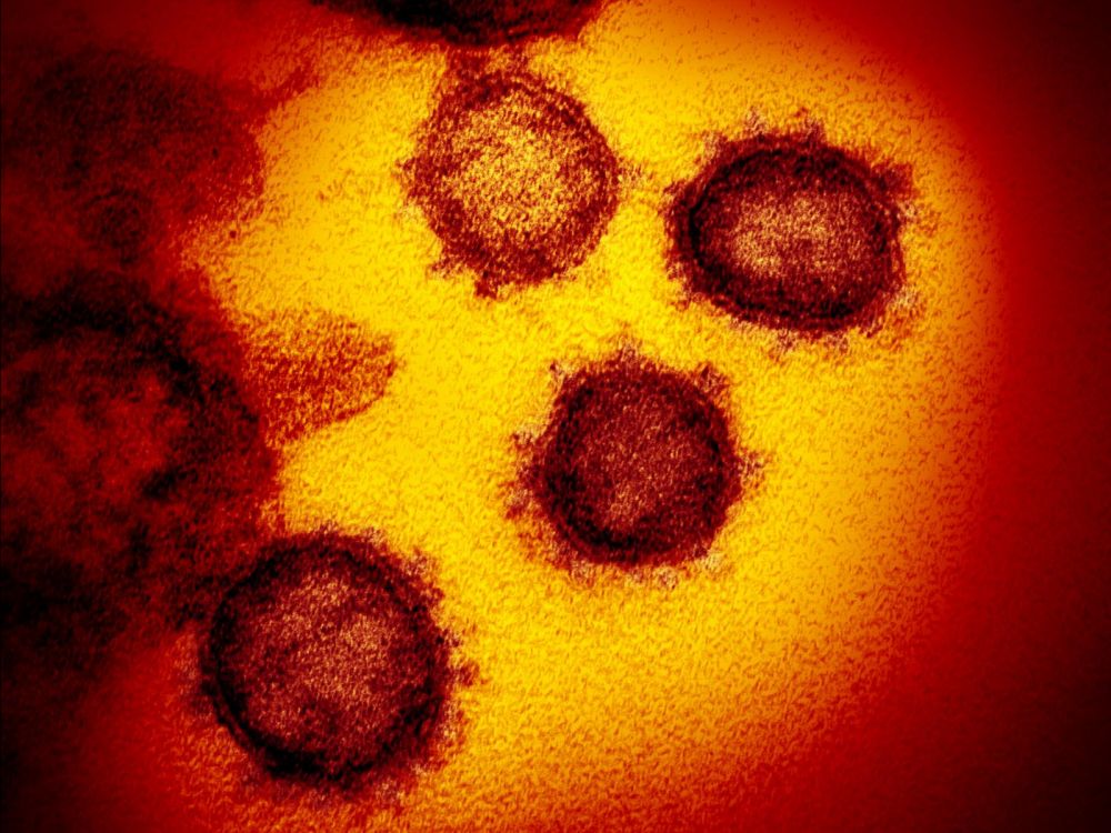 L’attribut alt de cette image est vide, son nom de fichier est imagecoronavirus.jpg.